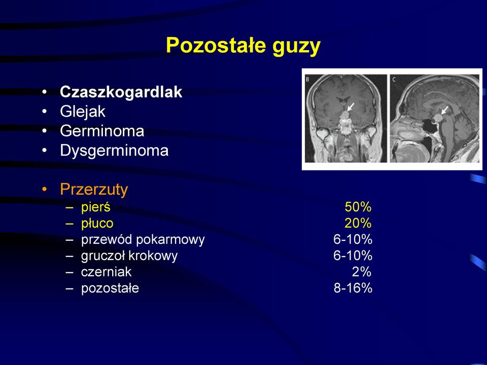 pierś 50% płuco 20% przewód pokarmowy