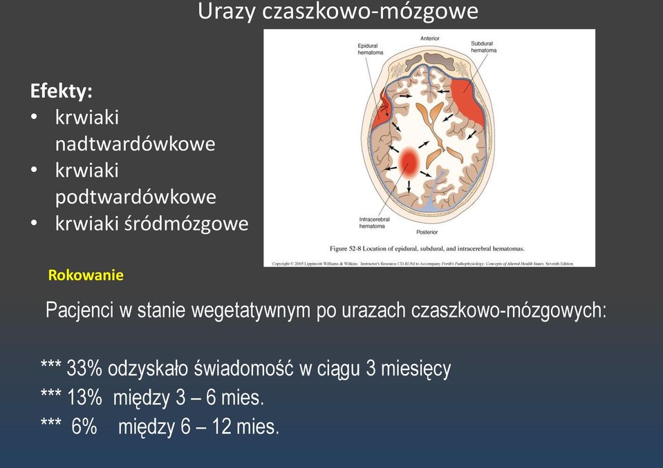 wegetatywnym po urazach czaszkowo-mózgowych: *** 33% odzyskało