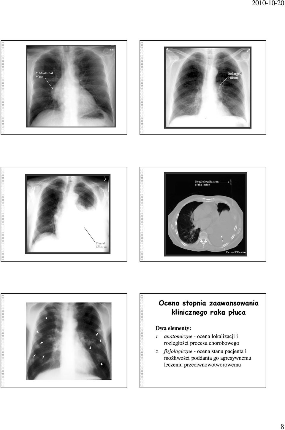 anatomiczne - ocena lokalizacji i rozległości procesu