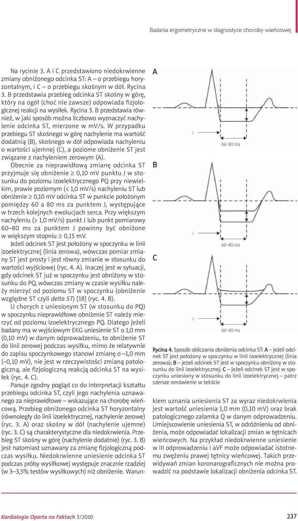 izoelektrycznej; C jeżeli odcinek ST jest w spoczynku uniesiony w stosunku do linii izoelektrycznej patrz szersze omówienie w tekście Na rycinie 3.