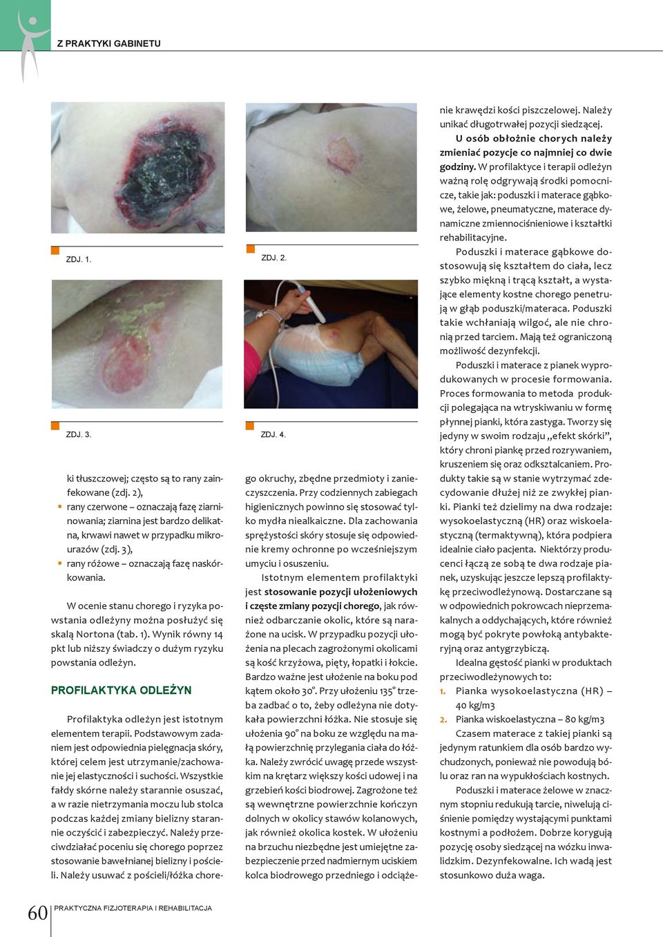 W ocenie stanu chorego i ryzyka powstania odleżyny można posłużyć się skalą Nortona (tab. 1). Wynik równy 14 pkt lub niższy świadczy o dużym ryzyku powstania odleżyn.