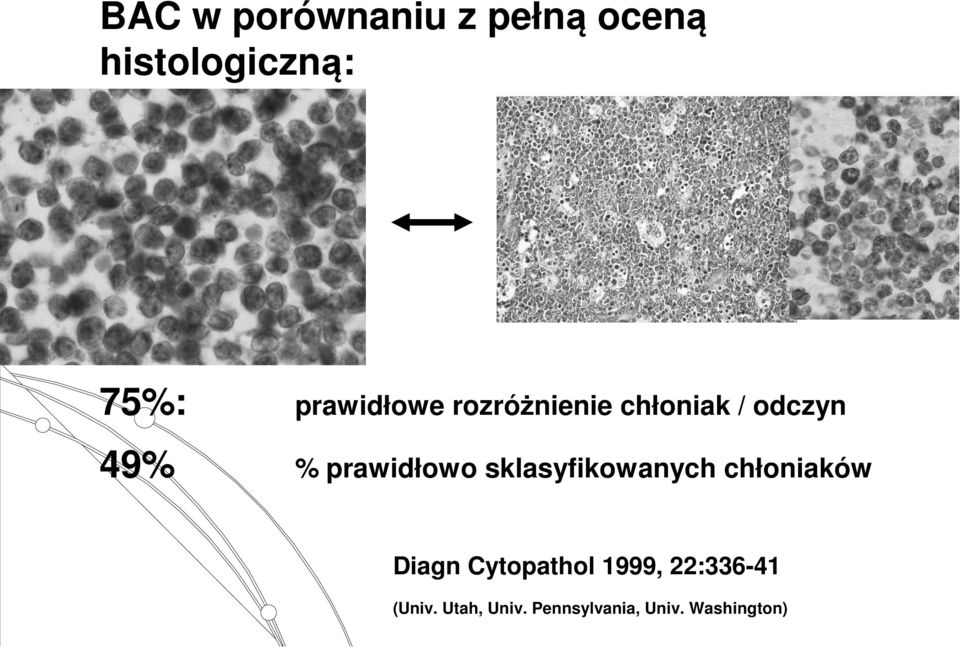 prawidłowo sklasyfikowanych chłoniaków Diagn Cytopathol
