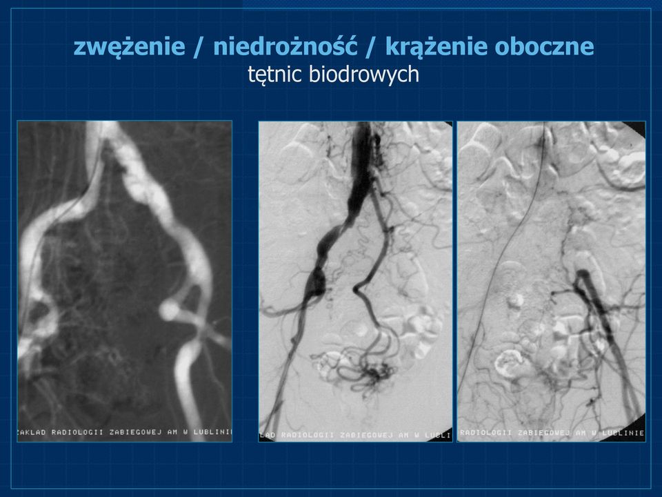 krążenie