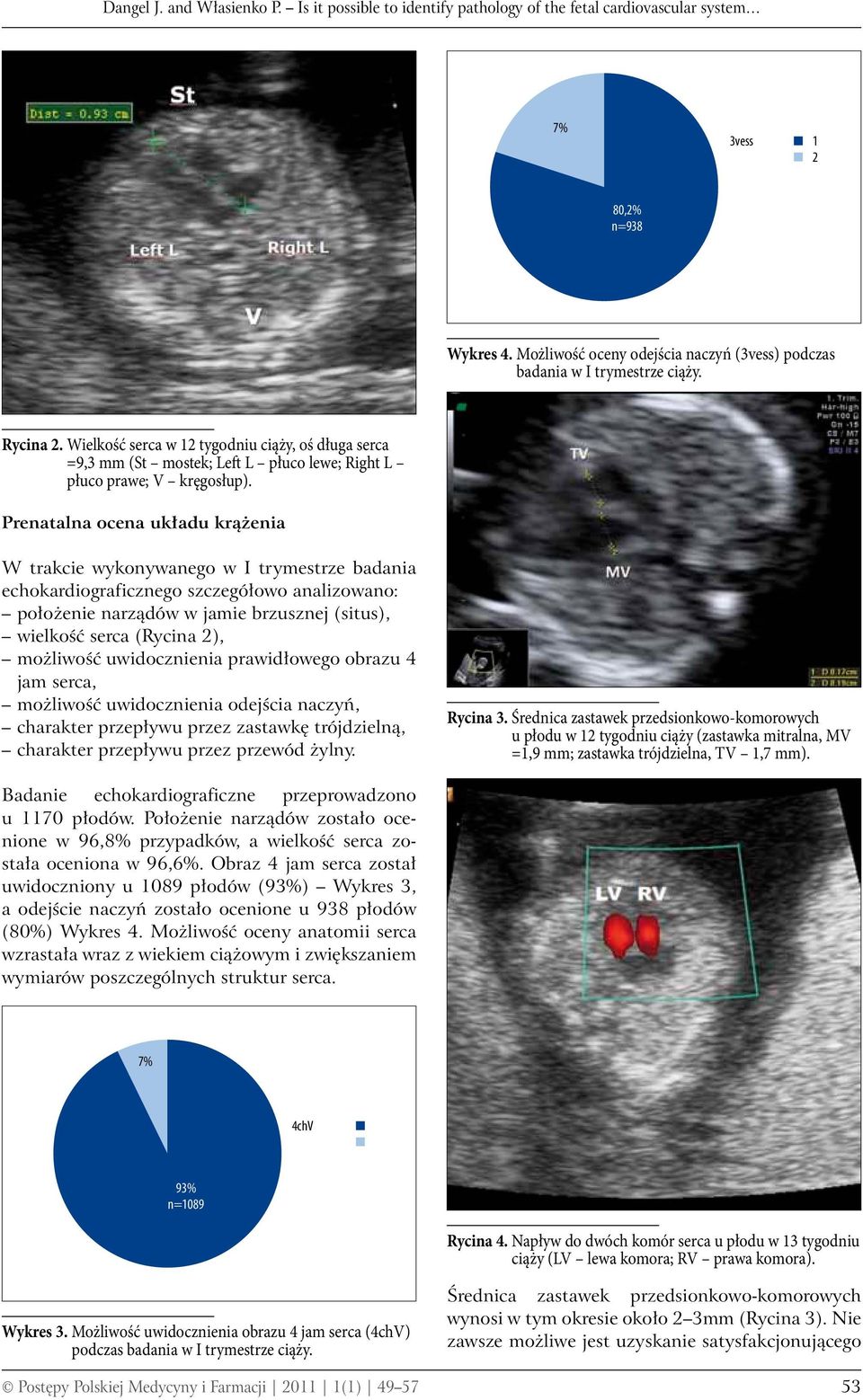Wielkość serca w 12 tygodniu ciąży, oś długa serca =9,3 mm (St mostek; Left L płuco lewe; Right L płuco prawe; V kręgosłup).