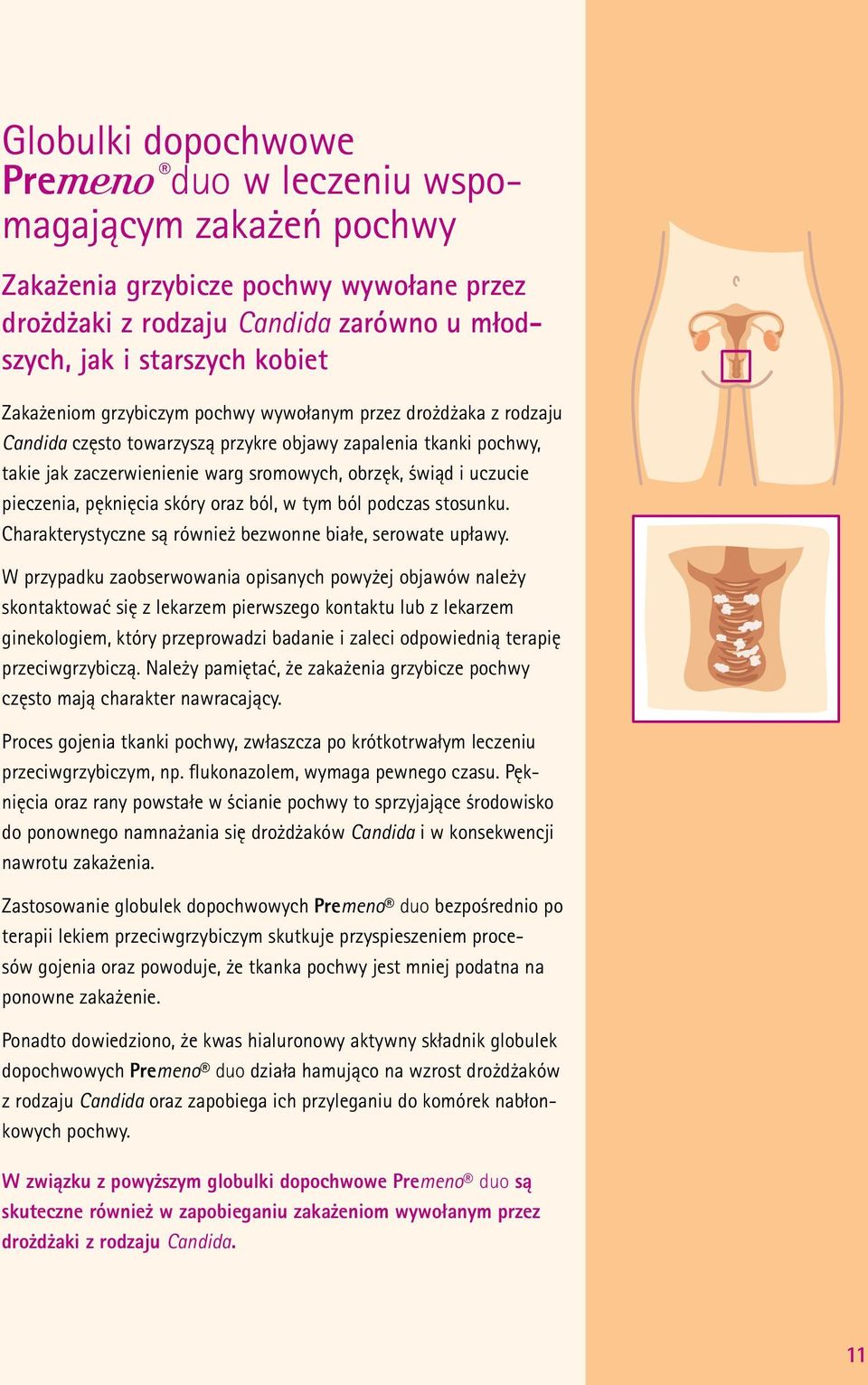 pęknięcia skóry oraz ból, w tym ból podczas stosunku. Charakterystyczne są również bezwonne białe, serowate upławy.