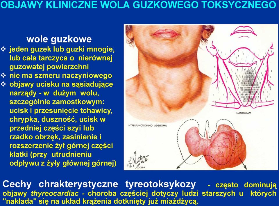 przedniej części szyi lub rzadko obrzęk, zasinienie i rozszerzenie żył górnej części klatki (przy utrudnieniu odpływu z żyły głównej górnej) Cechy