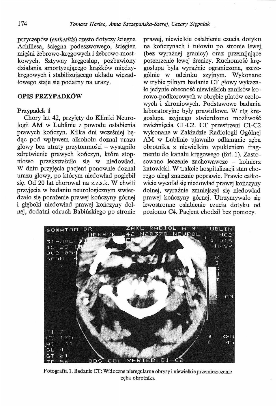 OPIS PRZYP ADKÓW Przypadek 1 Chory lat 42, przyjęty do Kliniki Neurologii AM w Lublinie z powodu osłabienia prawych kończyn.