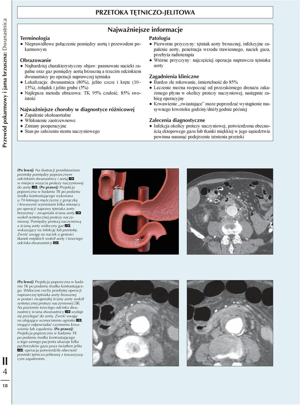 95% czułość, 85% swoistość Najważniejsze choroby w diagnostyce różnicowej Zapalenie okołoaortalne Włóknienie zaotrzewnowe Zmiany pooperacyjne Stan po założeniu stentu naczyniowego Najważniejsze