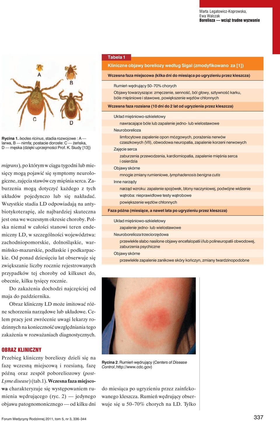 2 lat od ugryzienia przez kleszcza) Rycina 1. Ixodes ricinus, stadia rozwojowe : A larwa, B nimfa; postacie dorosłe: C żeńska, D męska (dzięki uprzejmości Prof. K.