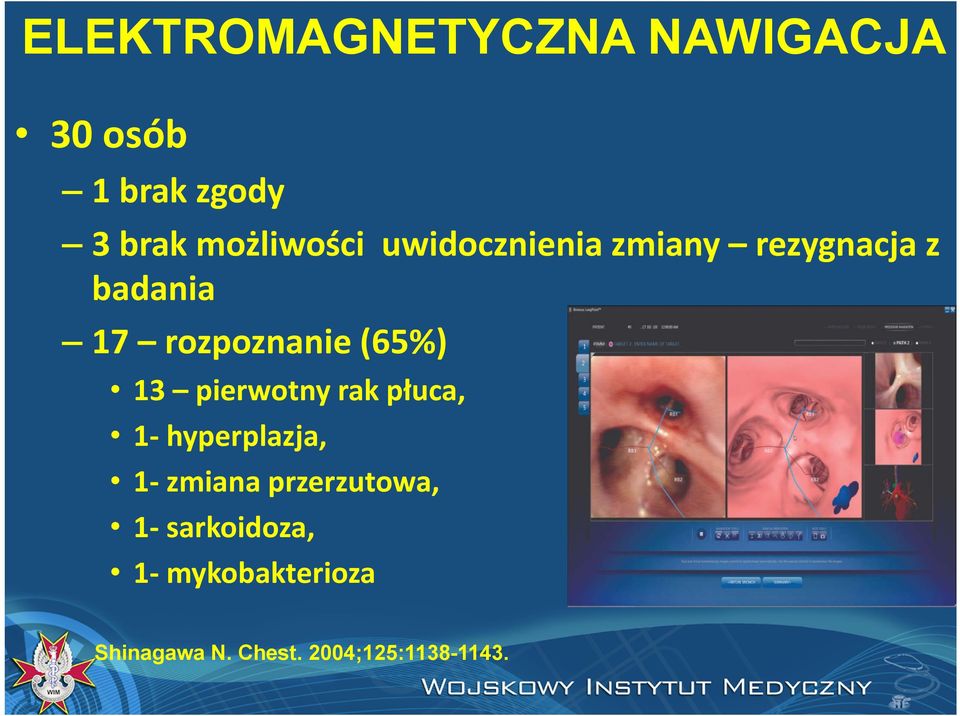 rozpoznanie(65%) 13 pierwotny rak płuca, 1 hyperplazja, 1 zmiana