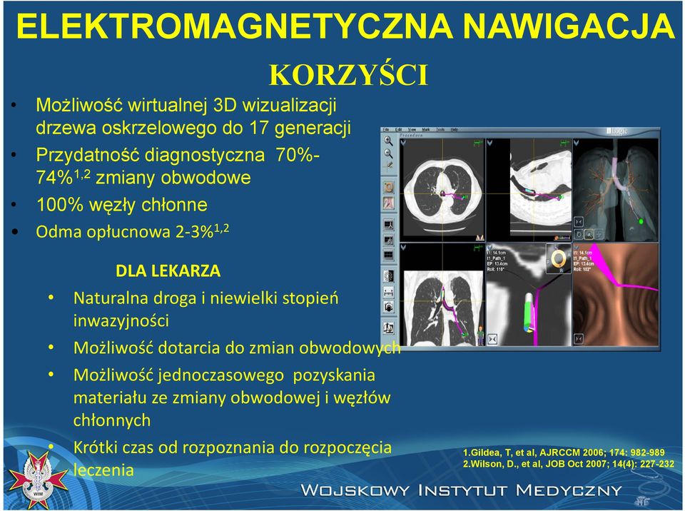 inwazyjności Możliwość dotarcia do zmian obwodowych Możliwość jednoczasowego pozyskania materiału ze zmiany obwodowej i węzłów