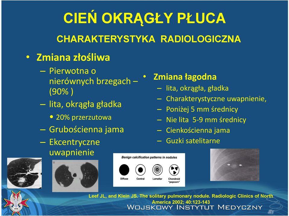 Charakterystyczne uwapnienie, Poniżej 5 mm średnicy Nie lita 5 9 mm średnicy Cienkościenna jama Guzki