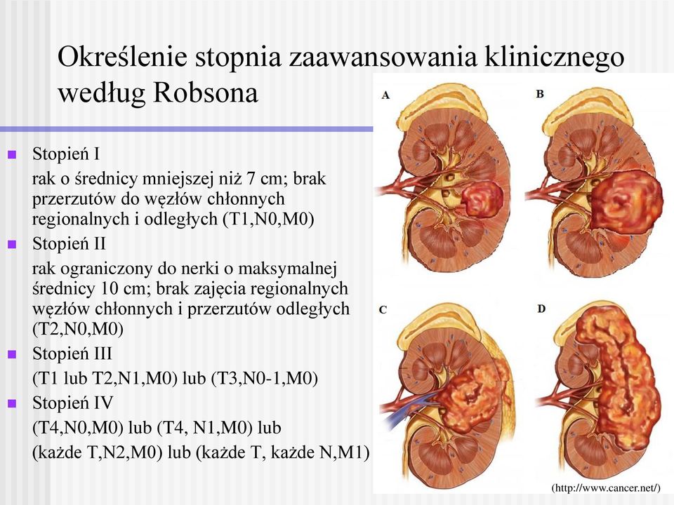 średnicy 10 cm; brak zajęcia regionalnych węzłów chłonnych i przerzutów odległych (T2,N0,M0) Stopień III (T1 lub