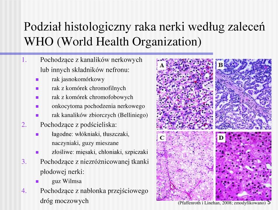 onkocytoma pochodzenia nerkowego rak kanalików zbiorczych (Belliniego) 2.