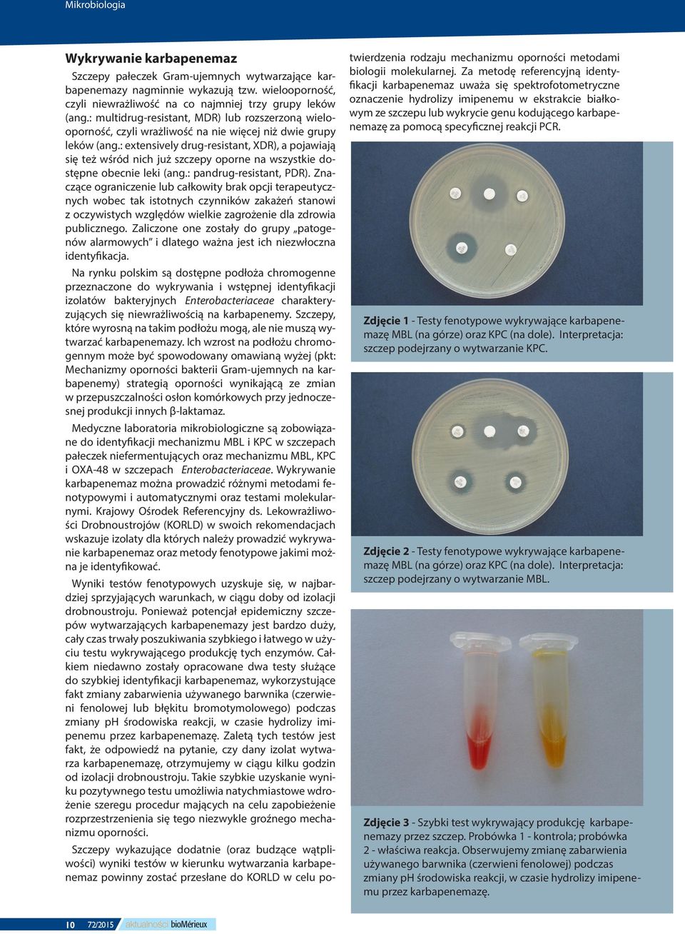 : extensively drug-resistant, XDR), a pojawiają się też wśród nich już szczepy oporne na wszystkie dostępne obecnie leki (ang.: pandrug-resistant, PDR).
