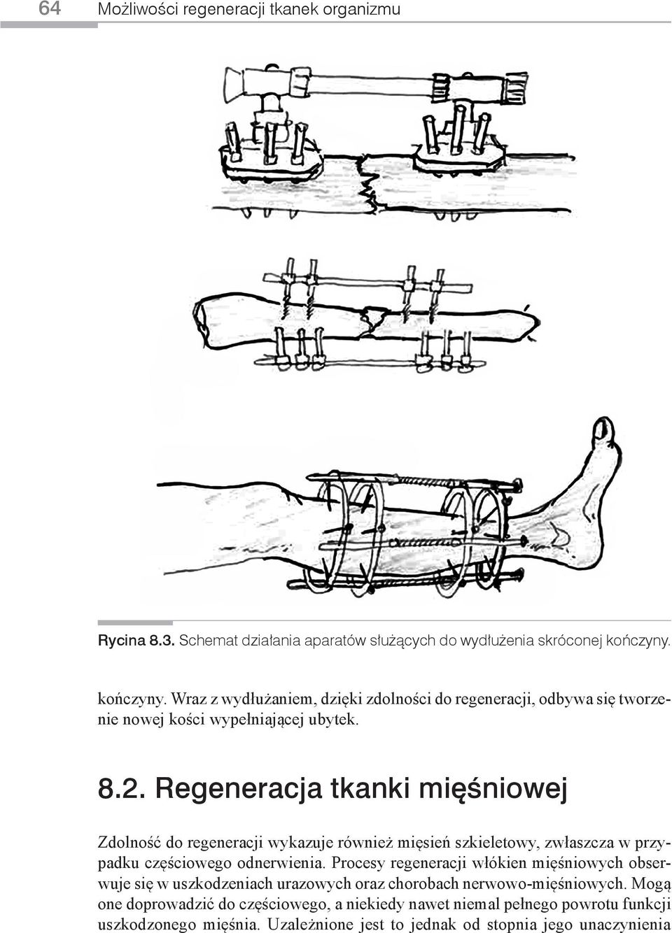 Regeneracja tkanki mięśniowej Zdolność do regeneracji wykazuje również mięsień szkieletowy, zwłaszcza w przypadku częściowego odnerwienia.