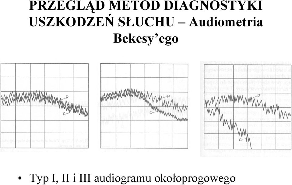 Audiometria Bekesy ego Typ