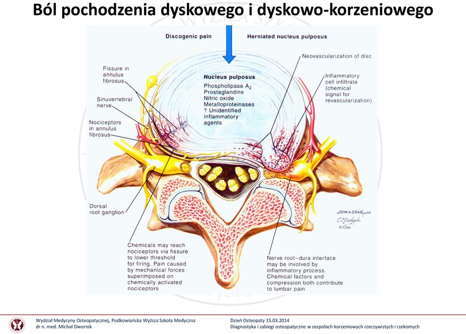 dyskowego i