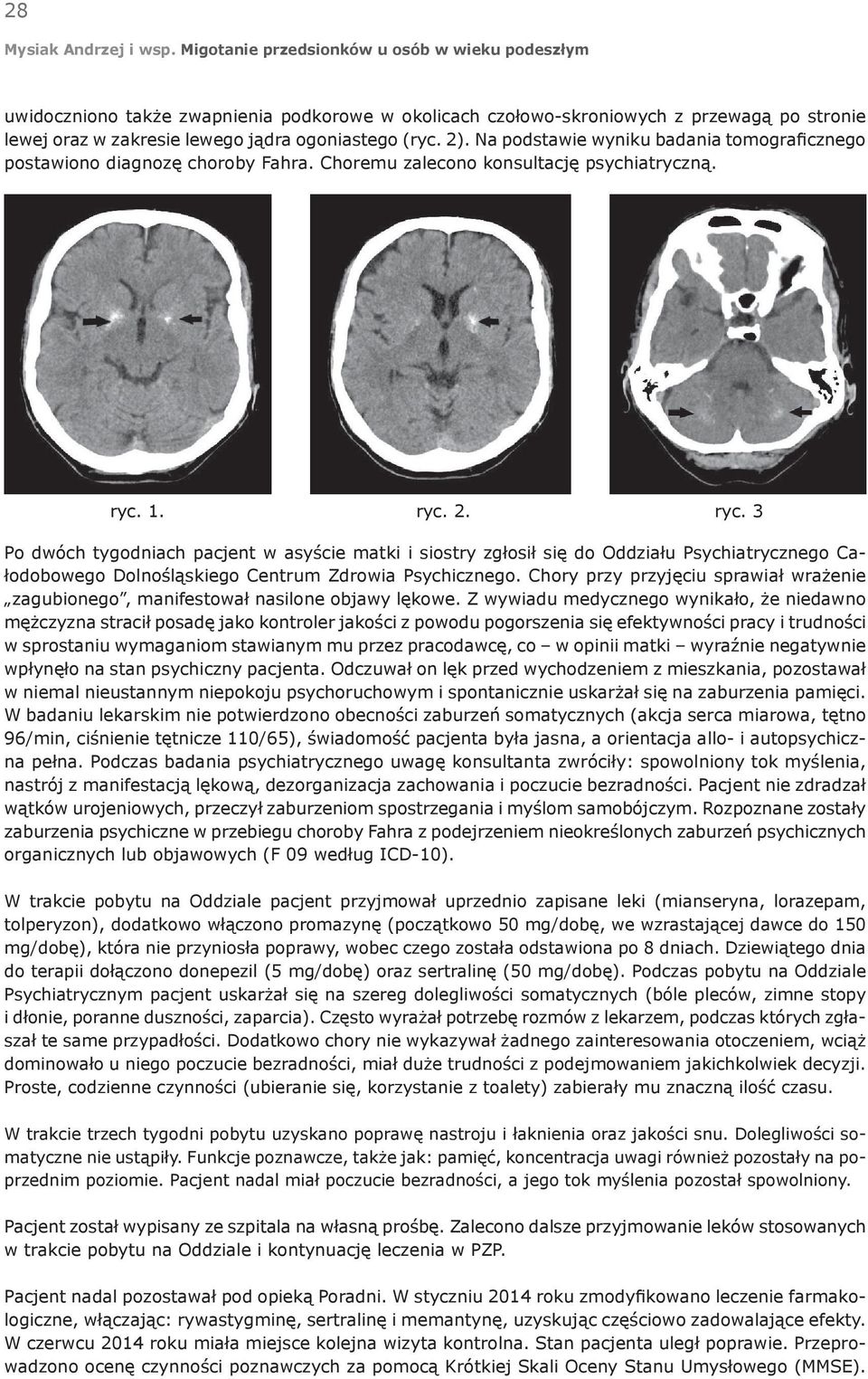 1. ryc. 2. ryc. 3 Po dwóch tygodniach pacjent w asyście matki i siostry zgłosił się do Oddziału Psychiatrycznego Całodobowego Dolnośląskiego Centrum Zdrowia Psychicznego.