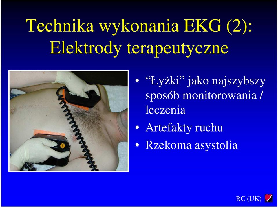 najszybszy sposób monitorowania /