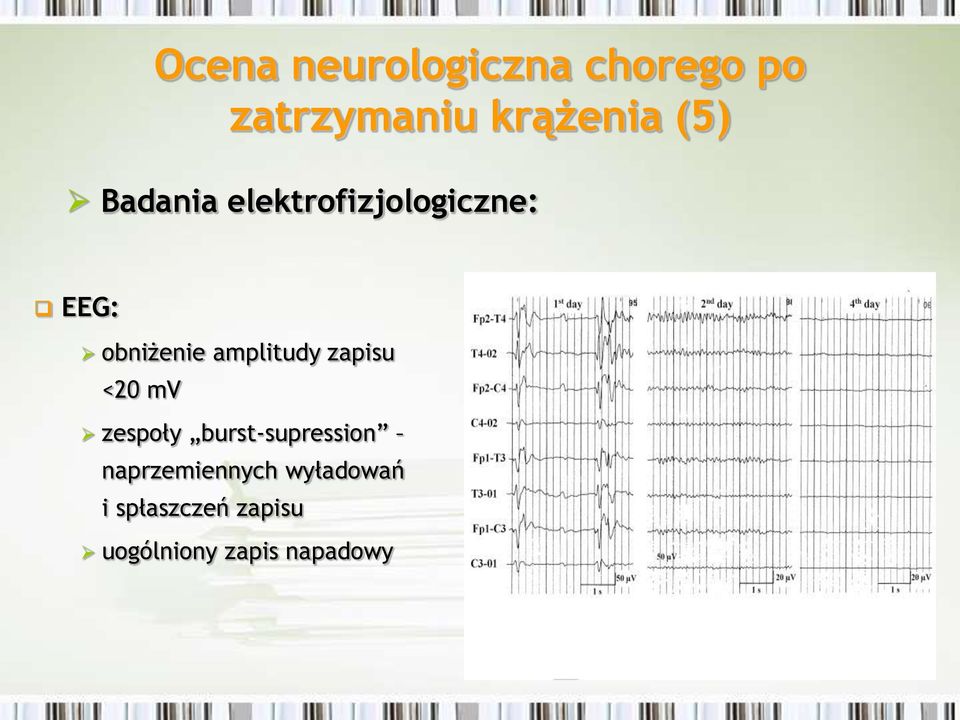 amplitudy zapisu <20 mv zespoły burst-supression