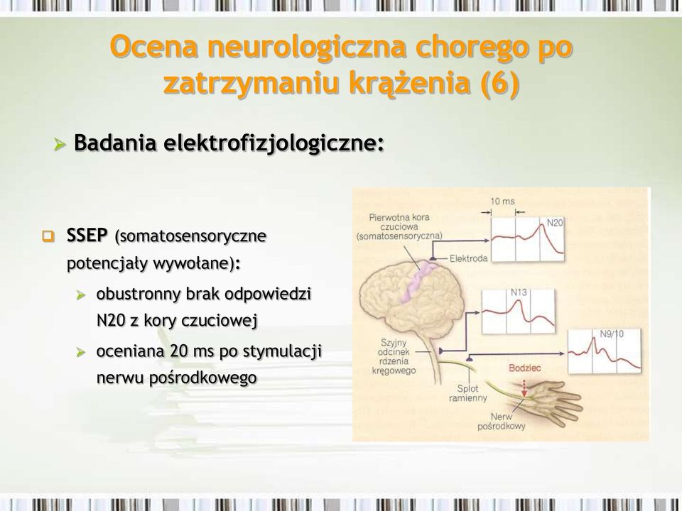 potencjały wywołane): obustronny brak odpowiedzi N20 z