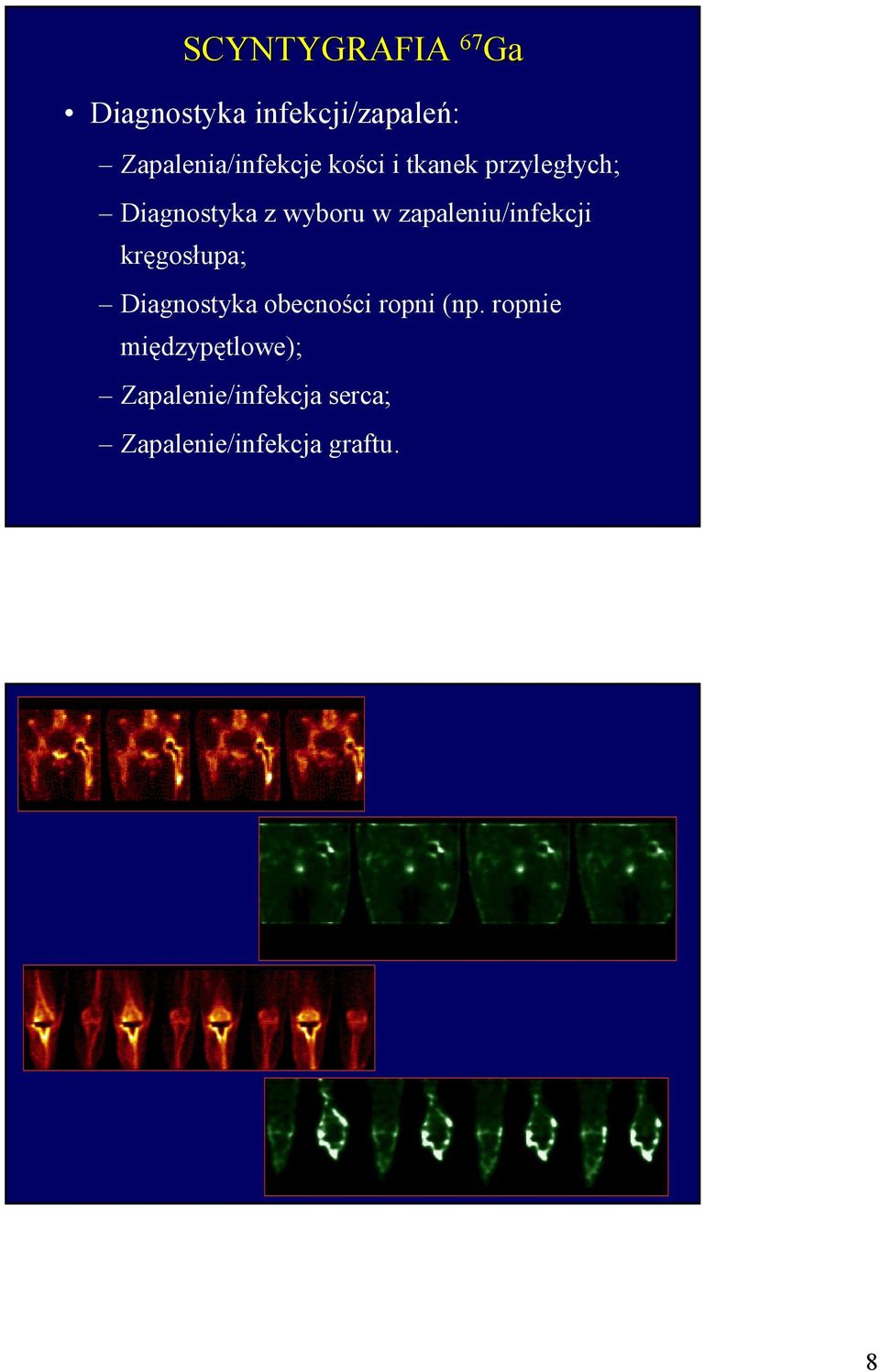 wyboru w zapaleniu/infekcji kręgosłupa; Diagnostyka obecności