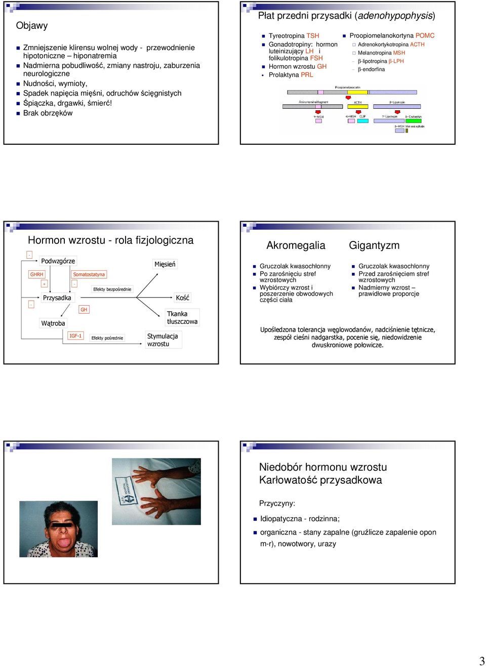 Brak obrzęków Płat przedni przysadki (adenohypophysis) Tyreotropina TSH Proopiomelanokortyna POMC Gonadotropiny: hormon Adrenokortykotropina ACTH luteinizujący LH i Melanotropina MSH folikulotropina