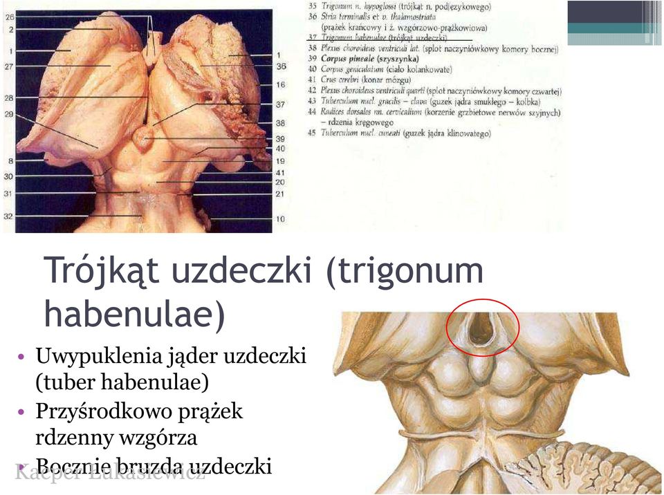 uzdeczki (tuber habenulae)