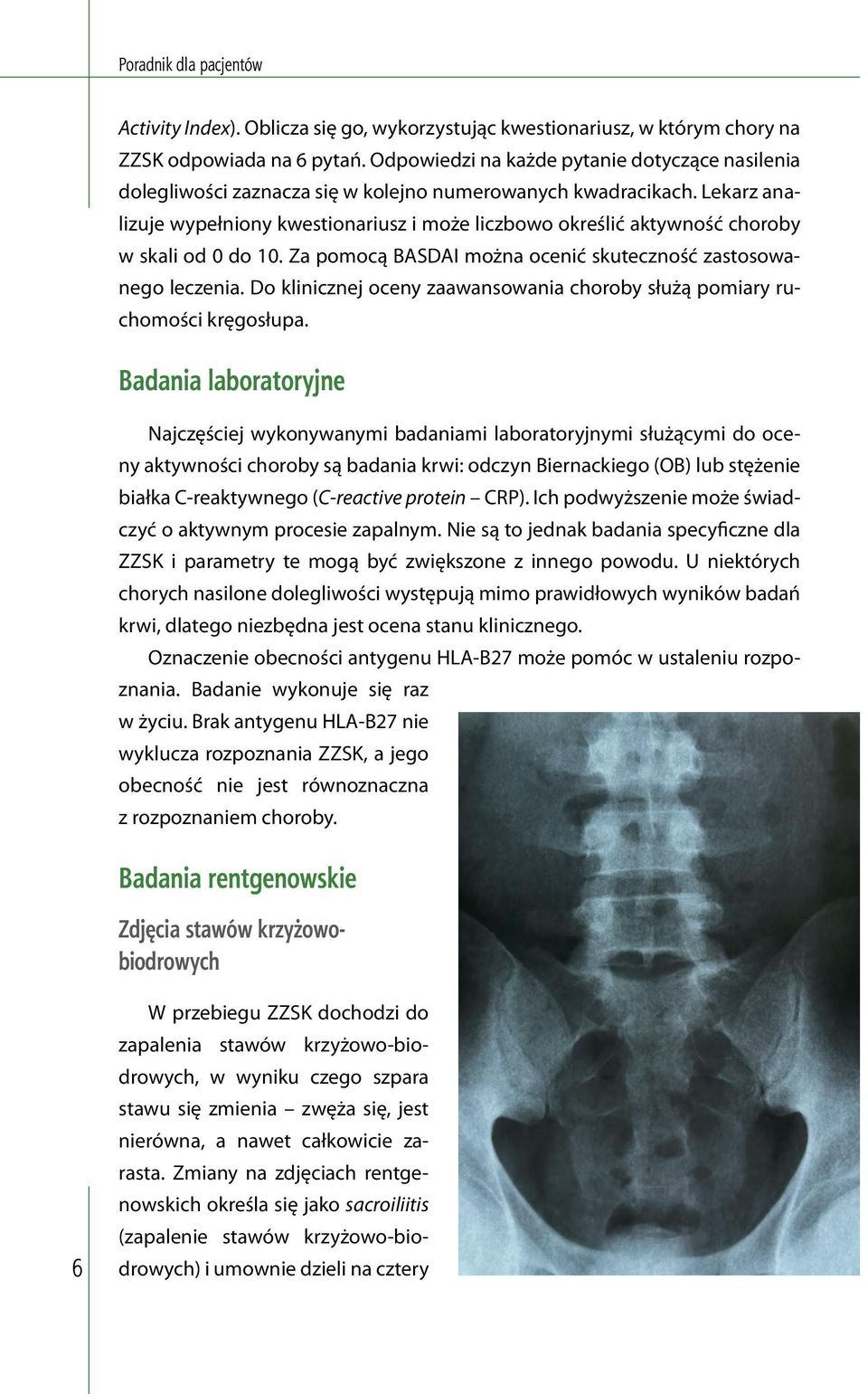 Lekarz analizuje wypełniony kwestionariusz i może liczbowo określić aktywność choroby w skali od 0 do 10. Za pomocą BASDAI można ocenić skuteczność zastosowanego leczenia.