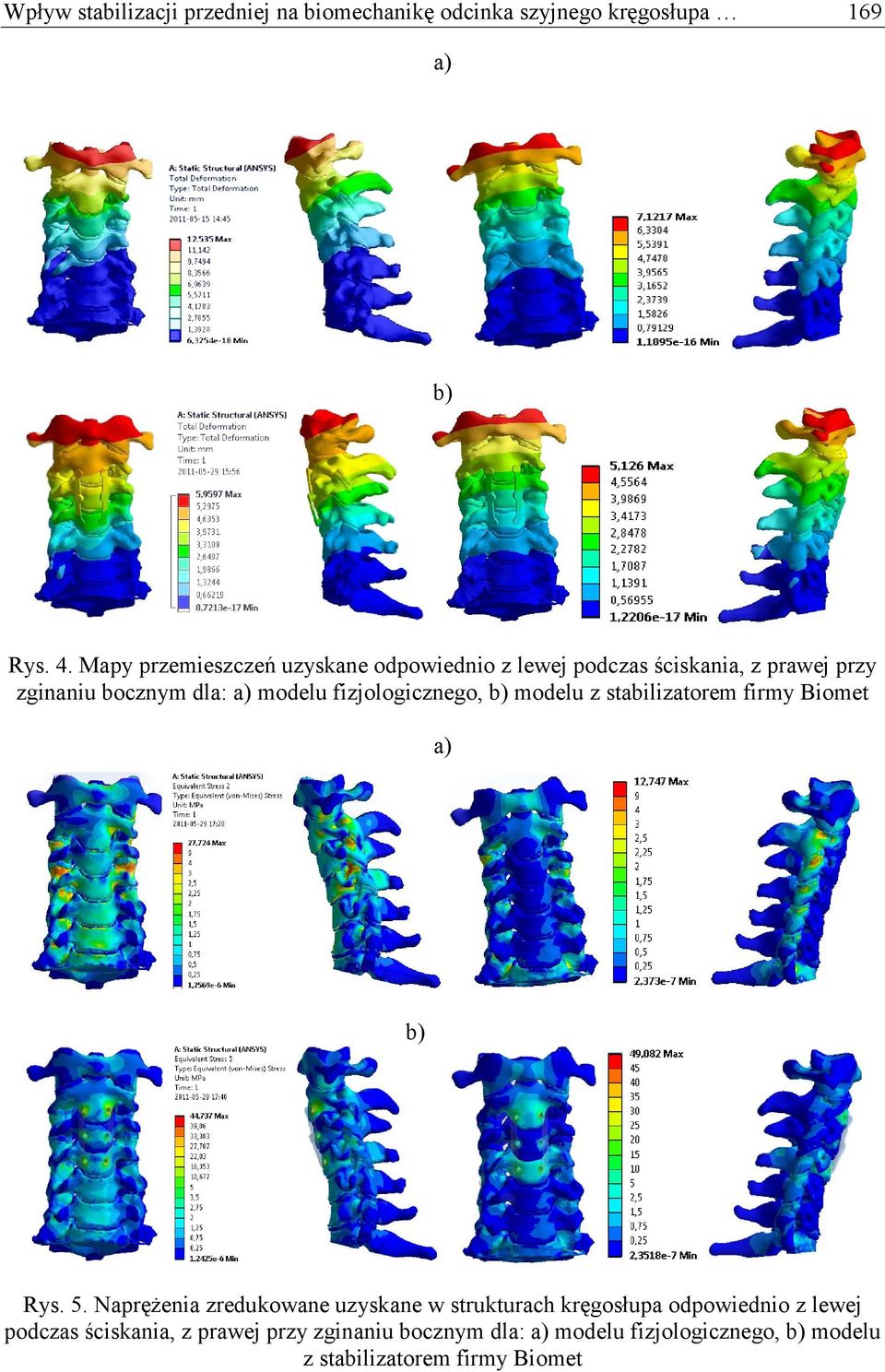 fizjologicznego, b) modelu z stabilizatorem firmy Biomet a) b) Rys. 5.