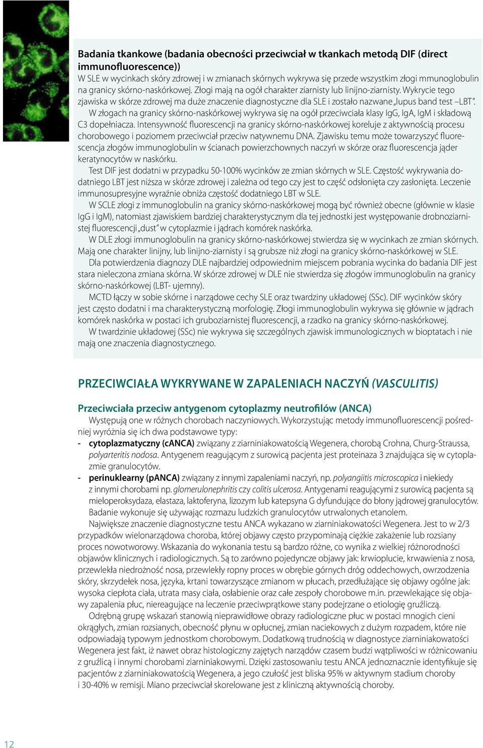 Wykrycie tego zjawiska w skórze zdrowej ma duże znaczenie diagnostyczne dla SLE i zostało nazwane lupus band test LBT.