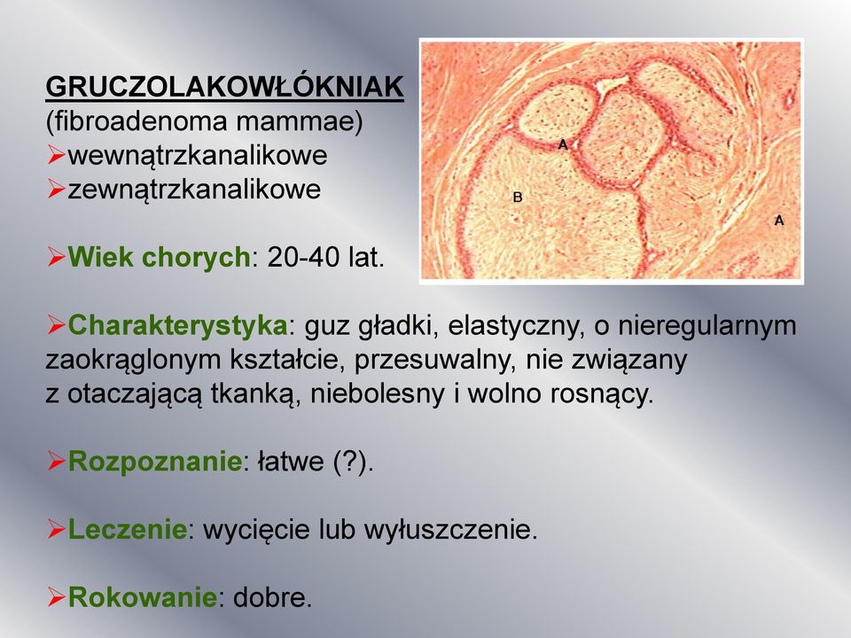 Charakterystyka: guz gładki, elastyczny, o nieregularnym zaokrąglonym kształcie,