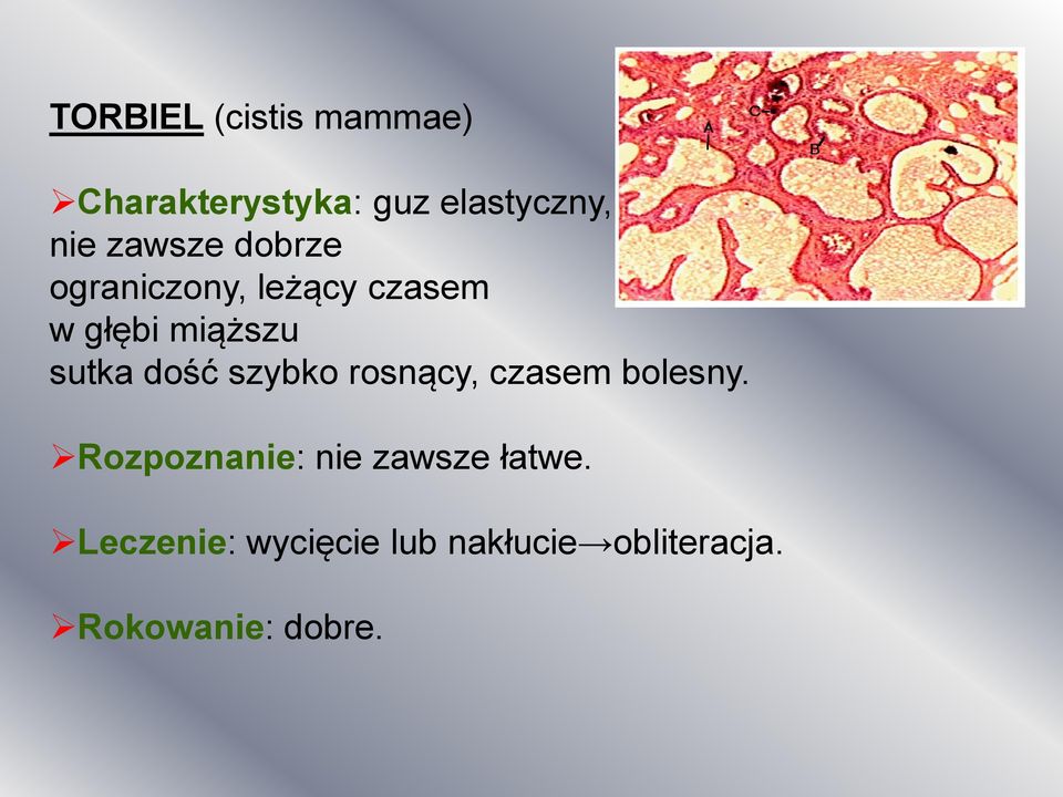 dość szybko rosnący, czasem bolesny.