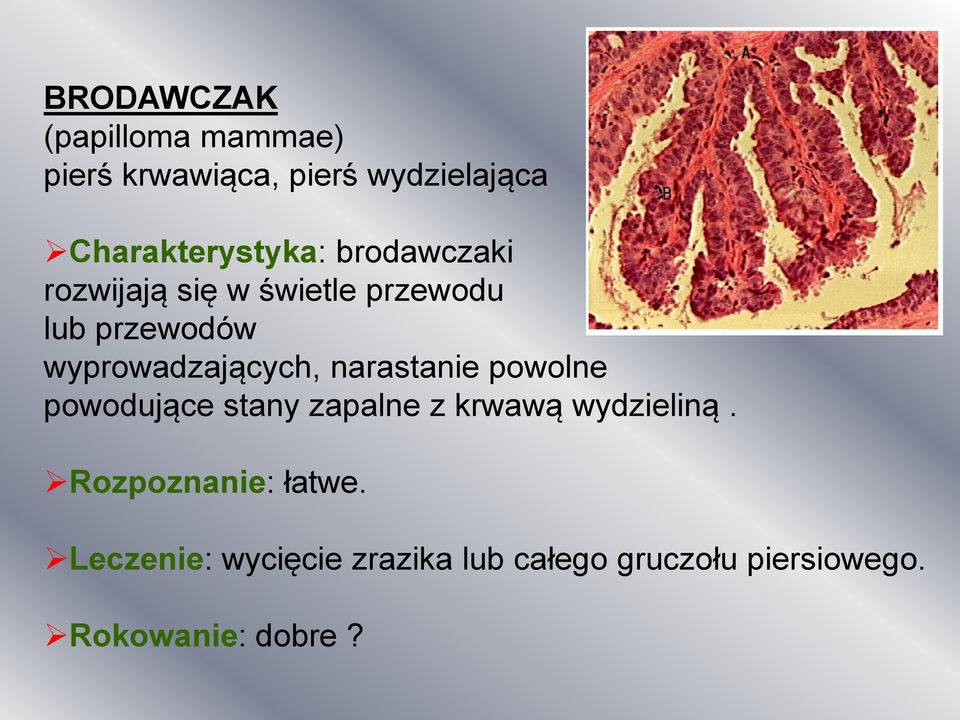 wyprowadzających, narastanie powolne powodujące stany zapalne z krwawą