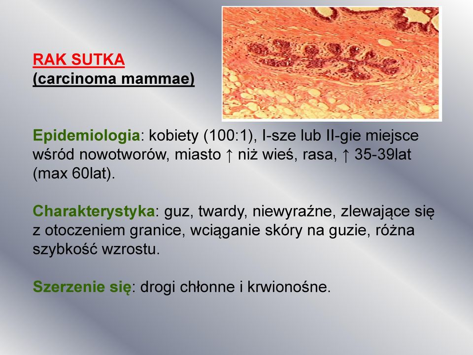 Charakterystyka: guz, twardy, niewyraźne, zlewające się z otoczeniem granice,