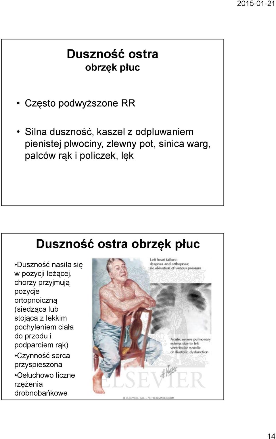 nasila się w pozycji leżącej, chorzy przyjmują pozycje ortopnoiczną (siedząca lub stojąca z lekkim