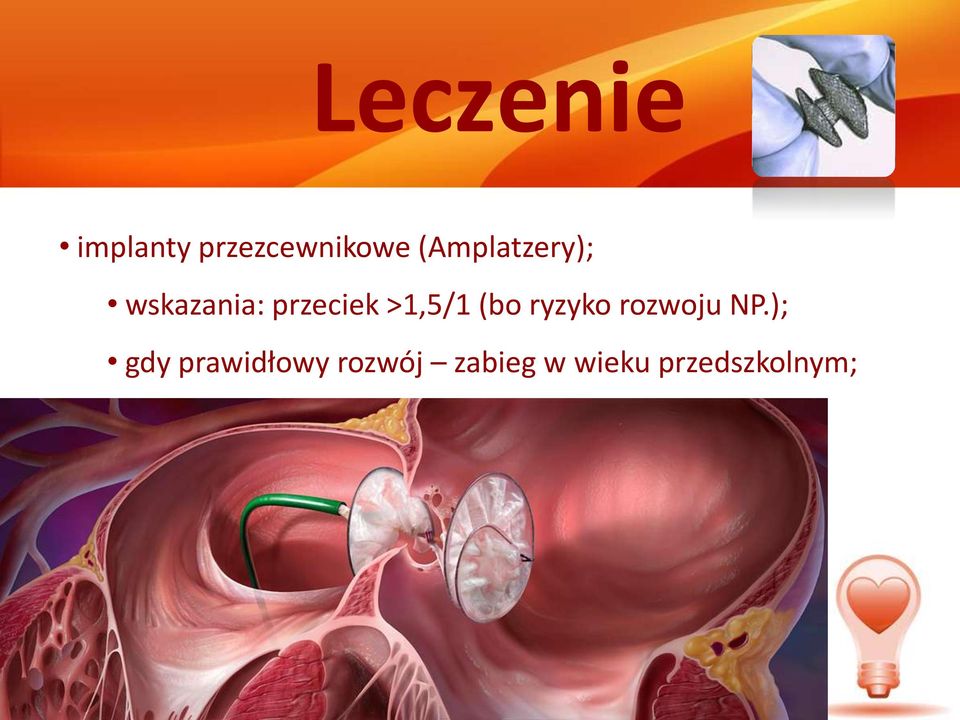 >1,5/1 (bo ryzyko rozwoju NP.
