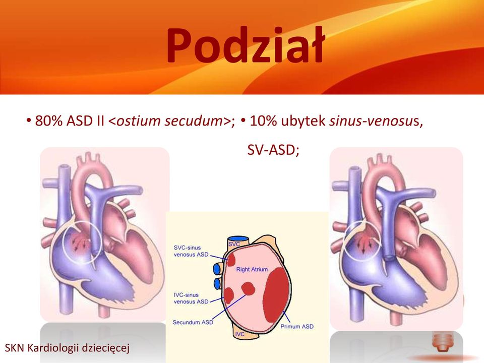 secudum>; 10%