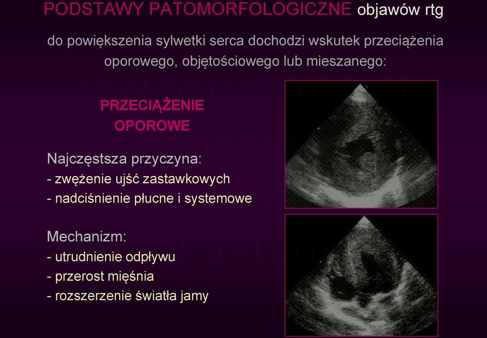 OPOROWE Najczęstsza przyczyna: - zwężenie ujść zastawkowych - nadciśnienie płucne