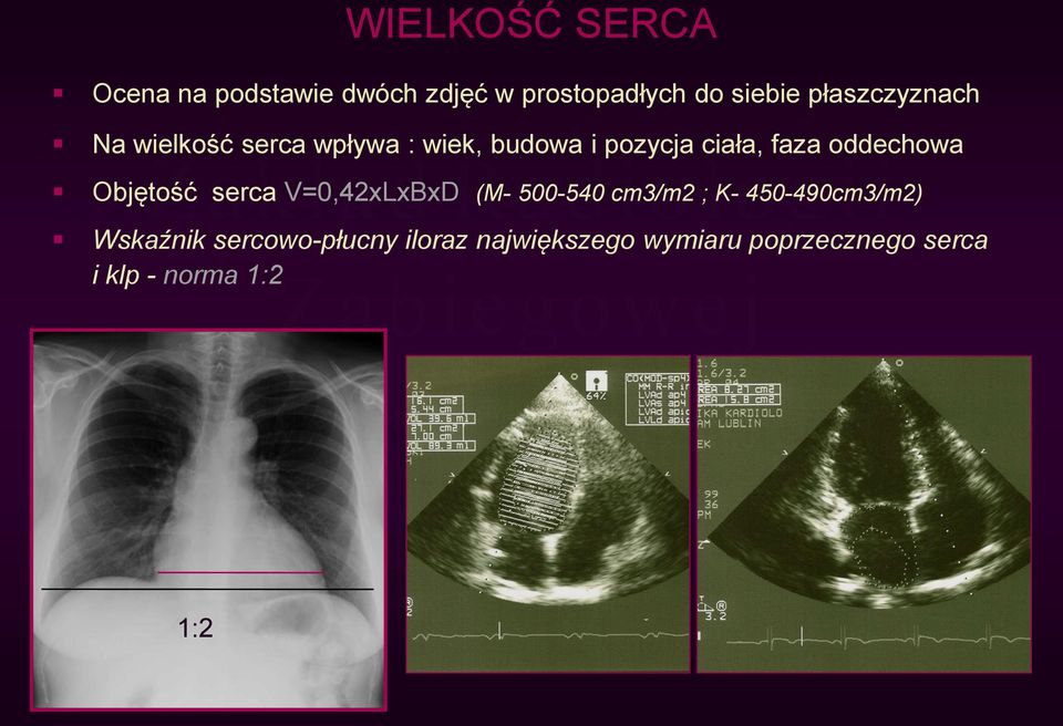 oddechowa Objętość serca V=0,42xLxBxD (M- 500-540 cm3/m2 ; K- 450-490cm3/m2)