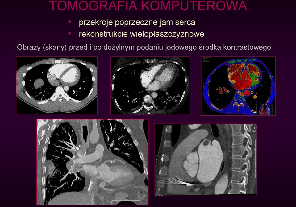 wielopłaszczyznowe Obrazy (skany) przed