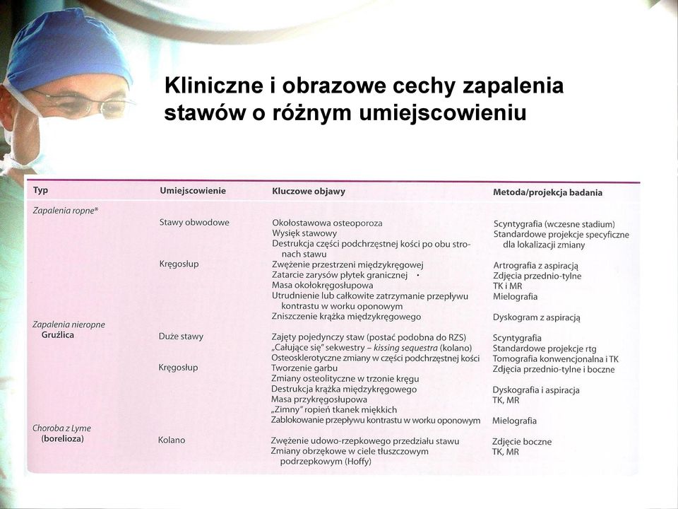 zapalenia stawów