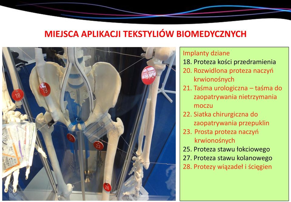 Taśma urologiczna taśma do zaopatrywania nietrzymania moczu 22.