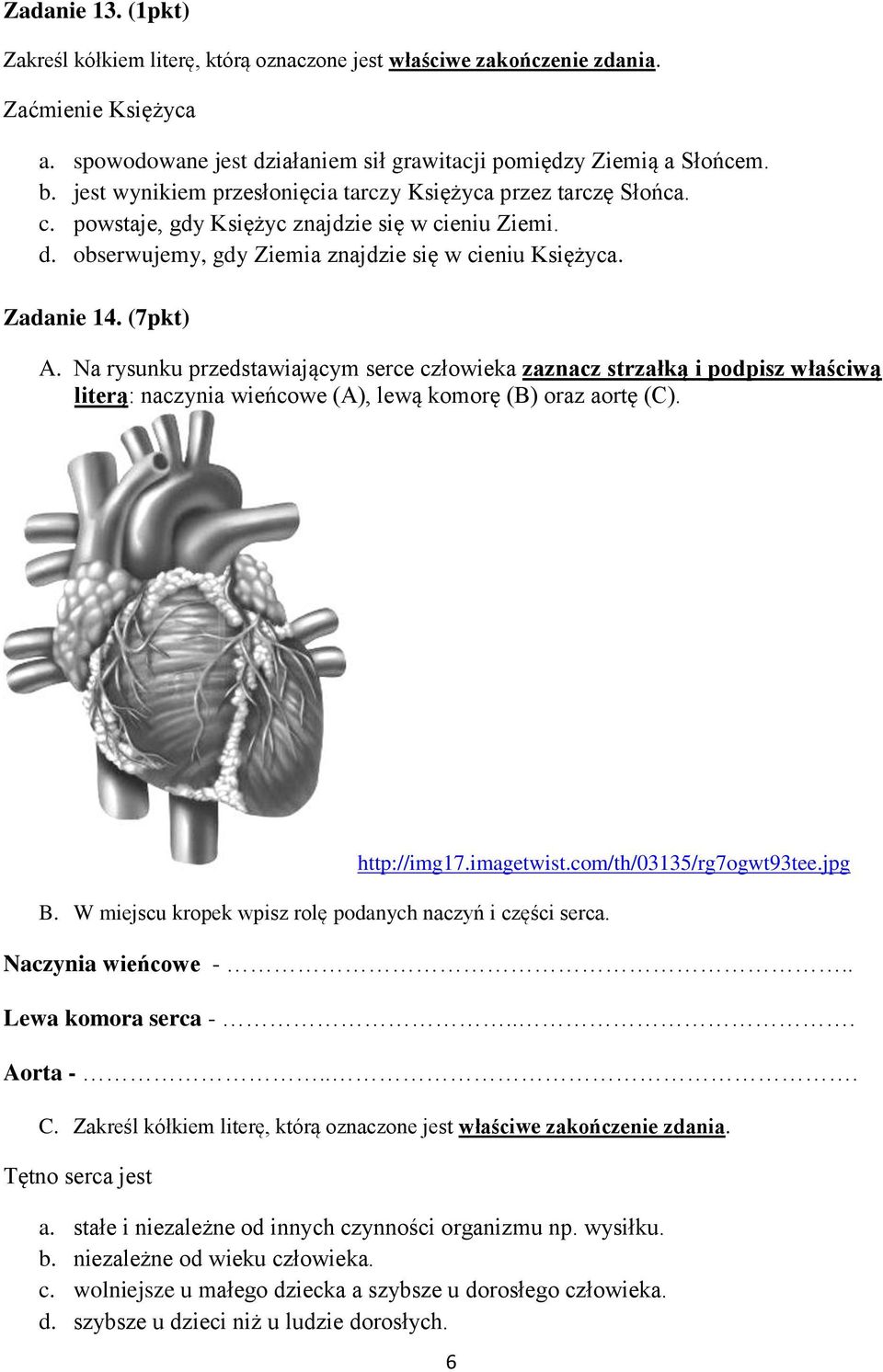 Na rysunku przedstawiającym serce człowieka zaznacz strzałką i podpisz właściwą literą: naczynia wieńcowe (A), lewą komorę (B) oraz aortę (C). http://img17.imagetwist.com/th/03135/rg7ogwt93tee.jpg B.