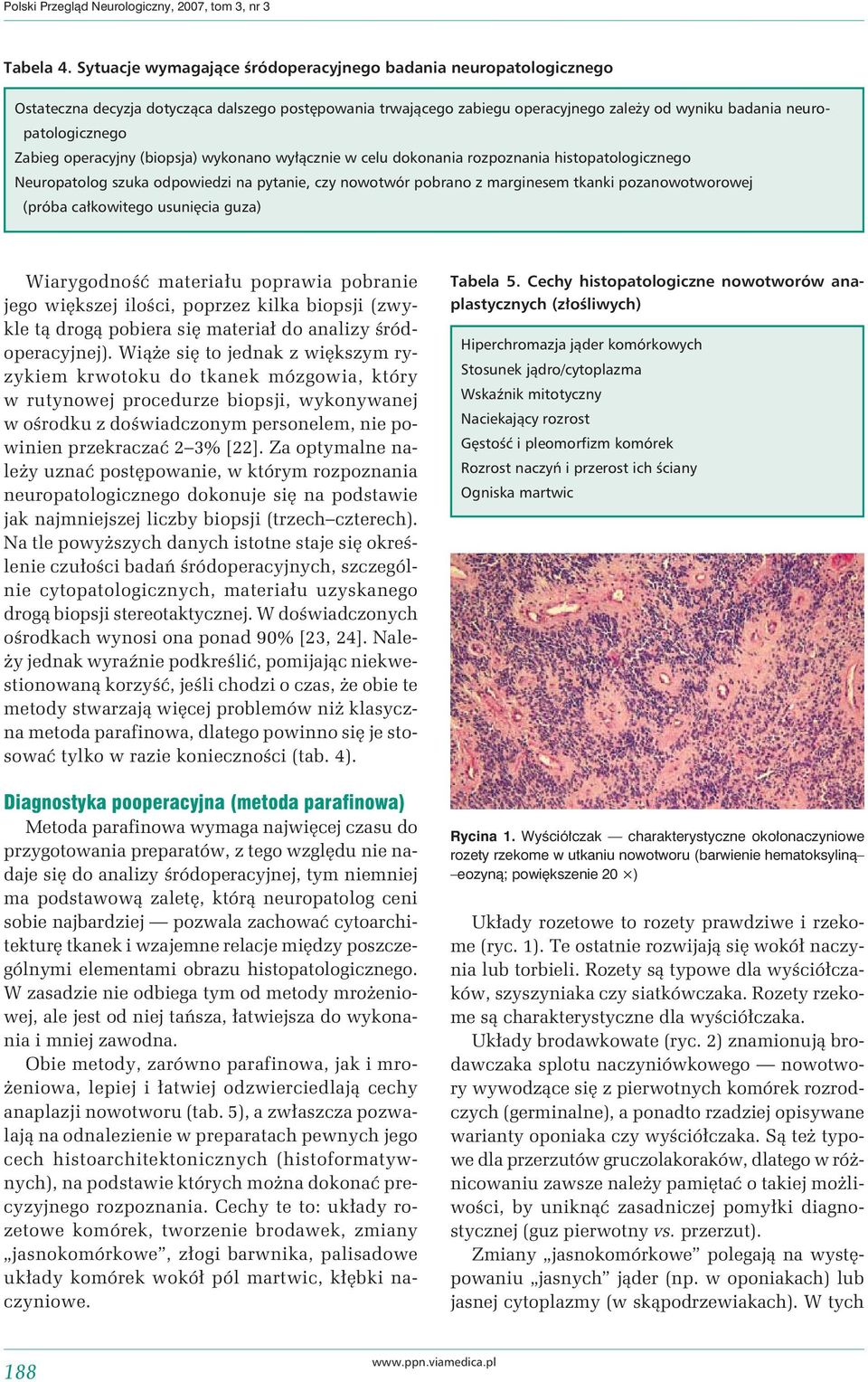 operacyjny (biopsja) wykonano wyłącznie w celu dokonania rozpoznania histopatologicznego Neuropatolog szuka odpowiedzi na pytanie, czy nowotwór pobrano z marginesem tkanki pozanowotworowej (próba