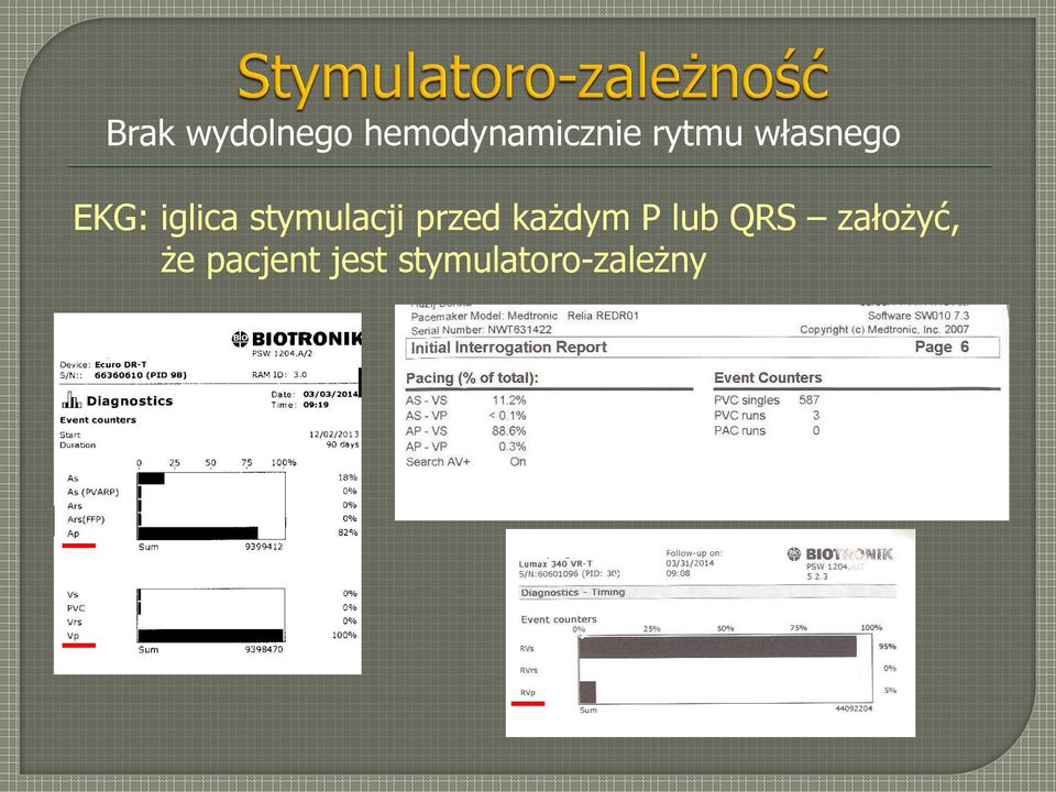 przed każdym P lub QRS założyć, że