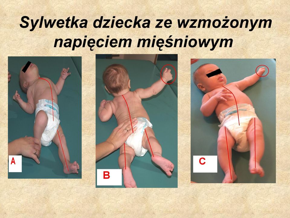 wzmożonym