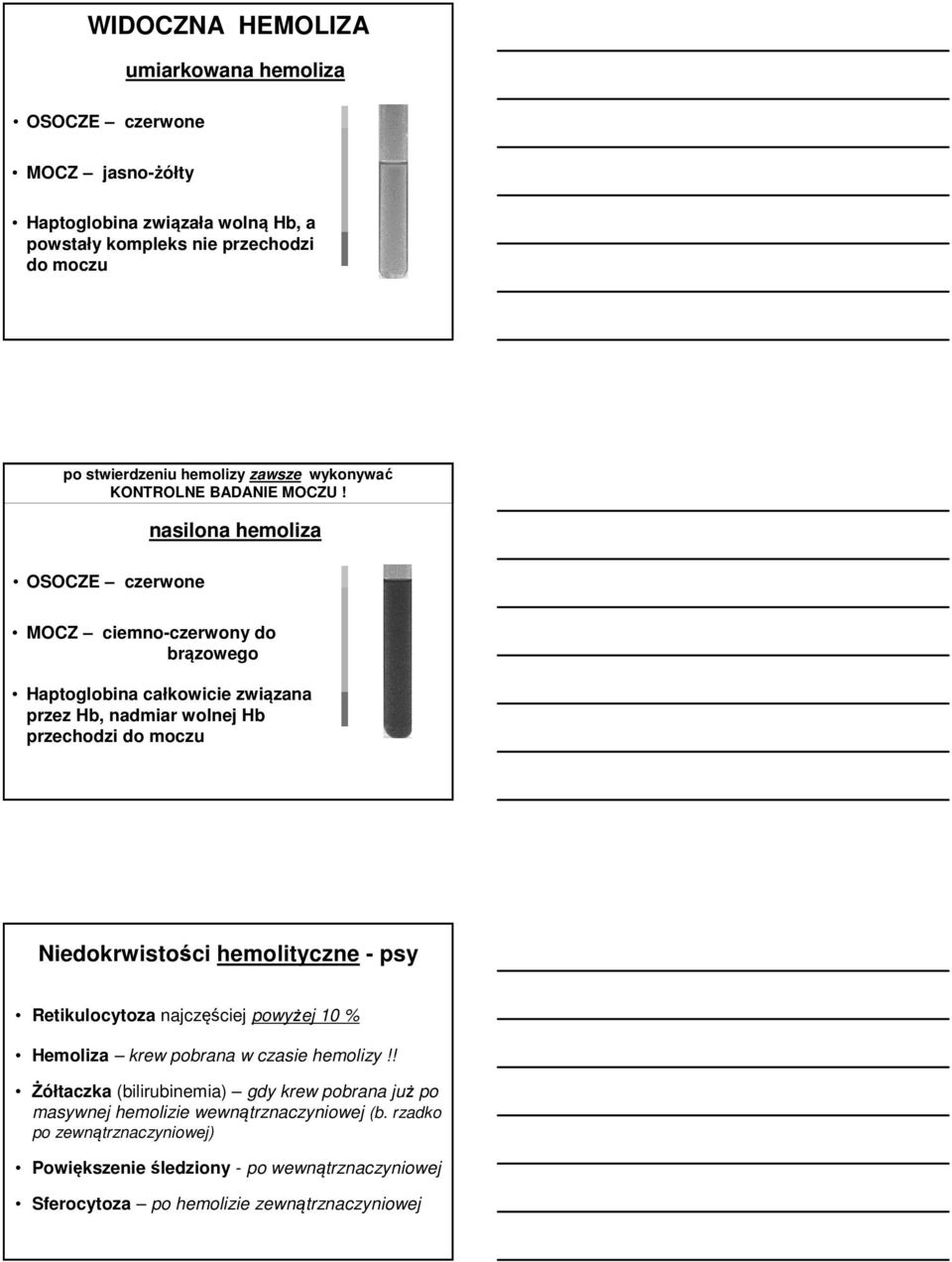 nasilona hemoliza OSOCZE czerwone MOCZ ciemno-czerwony do brązowego Haptoglobina całkowicie związana przez Hb, nadmiar wolnej Hb przechodzi do moczu Niedokrwistości hemolityczne