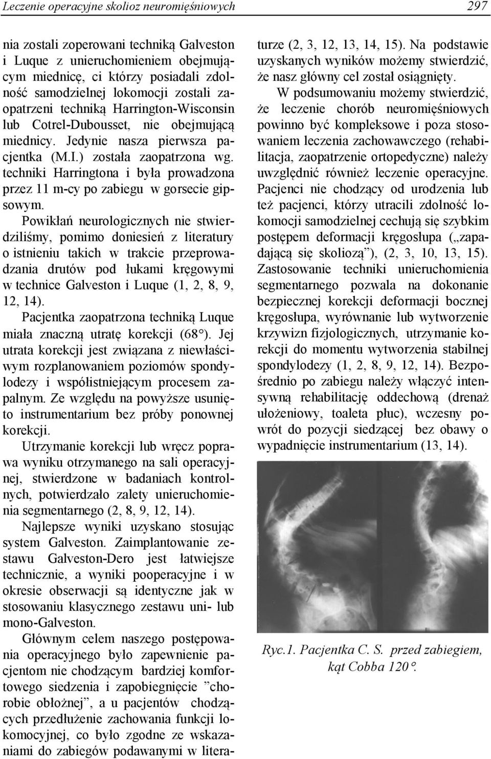 techniki Harringtona i była prowadzona przez 11 m-cy po zabiegu w gorsecie gipsowym.